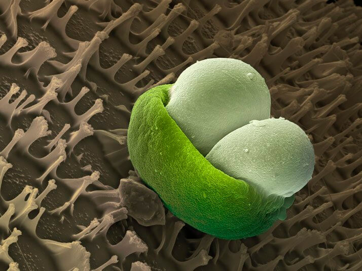 Grano de polen de pino visto al microscopio electrónico